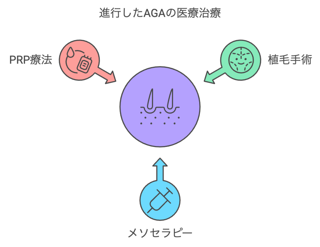 進行したAGAへの医療行為